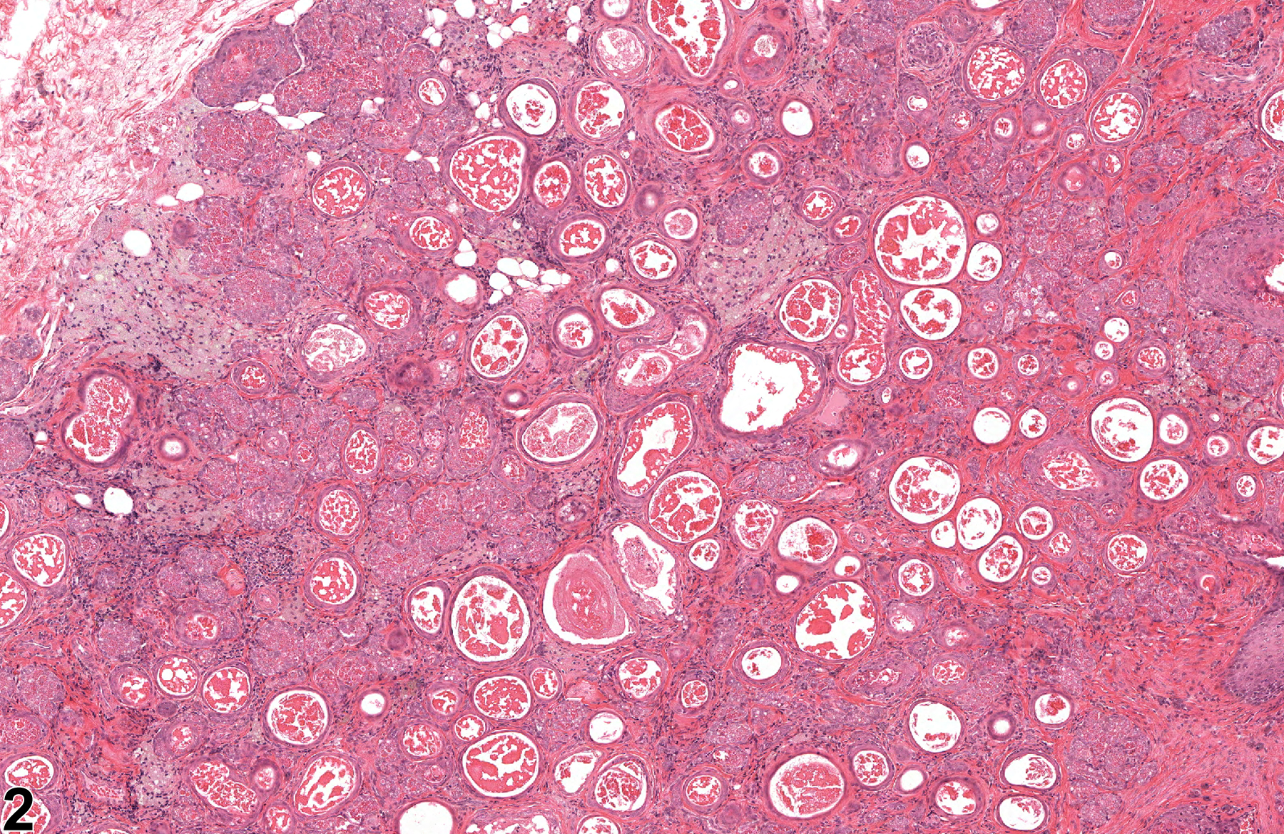Image of atrophy in the clitoral gland from a female F344/N rat in a chronic study