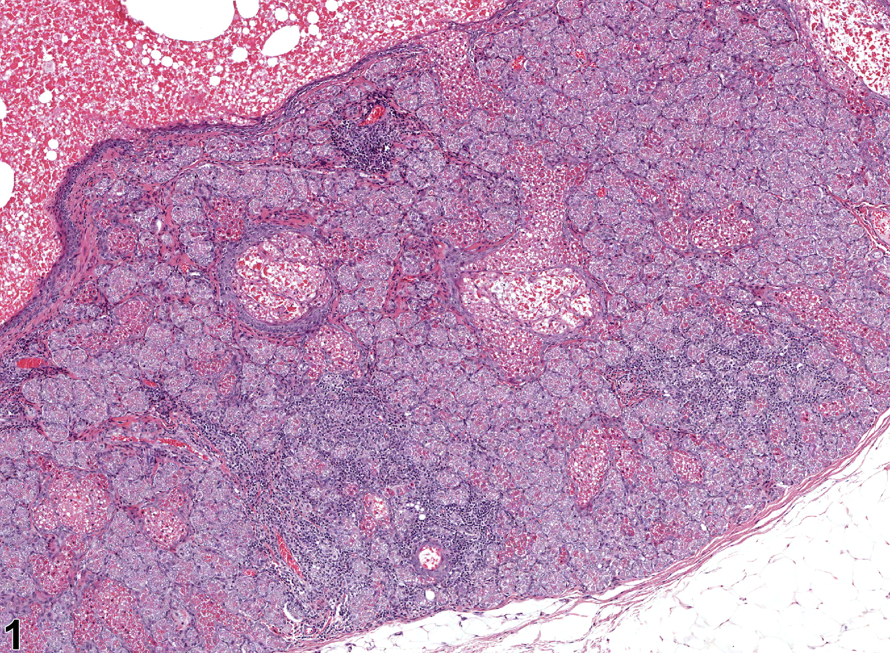 Image of infiltration cellular in the clitoral gland from a female F344/N rat in a chronic study