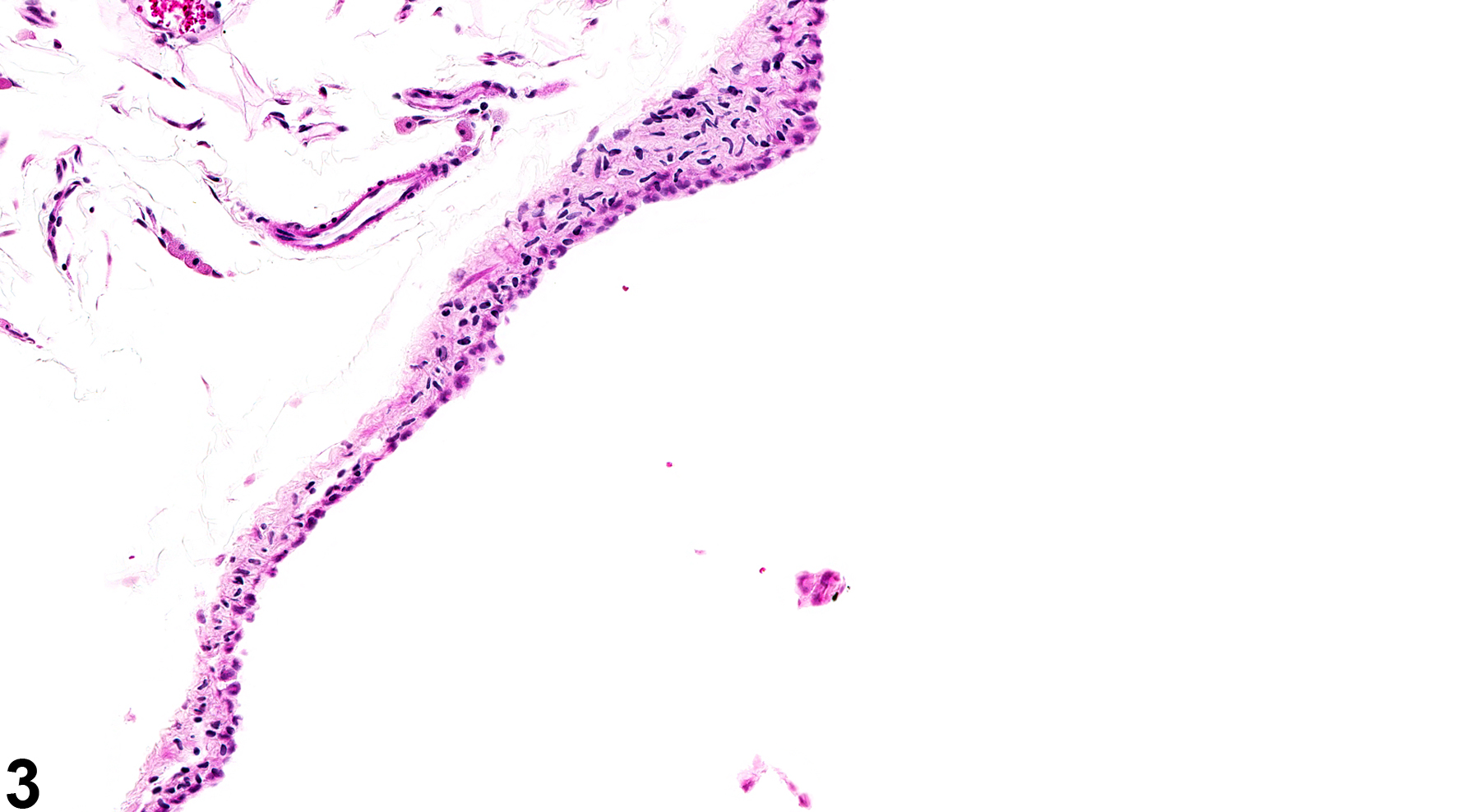 Image of bursal cyst in the ovary from a female F344/N rat in a chronic study
