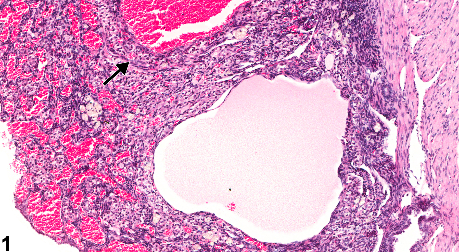 Image of cyst in the ovary from a female B6C3F1 mouse in a chronic study