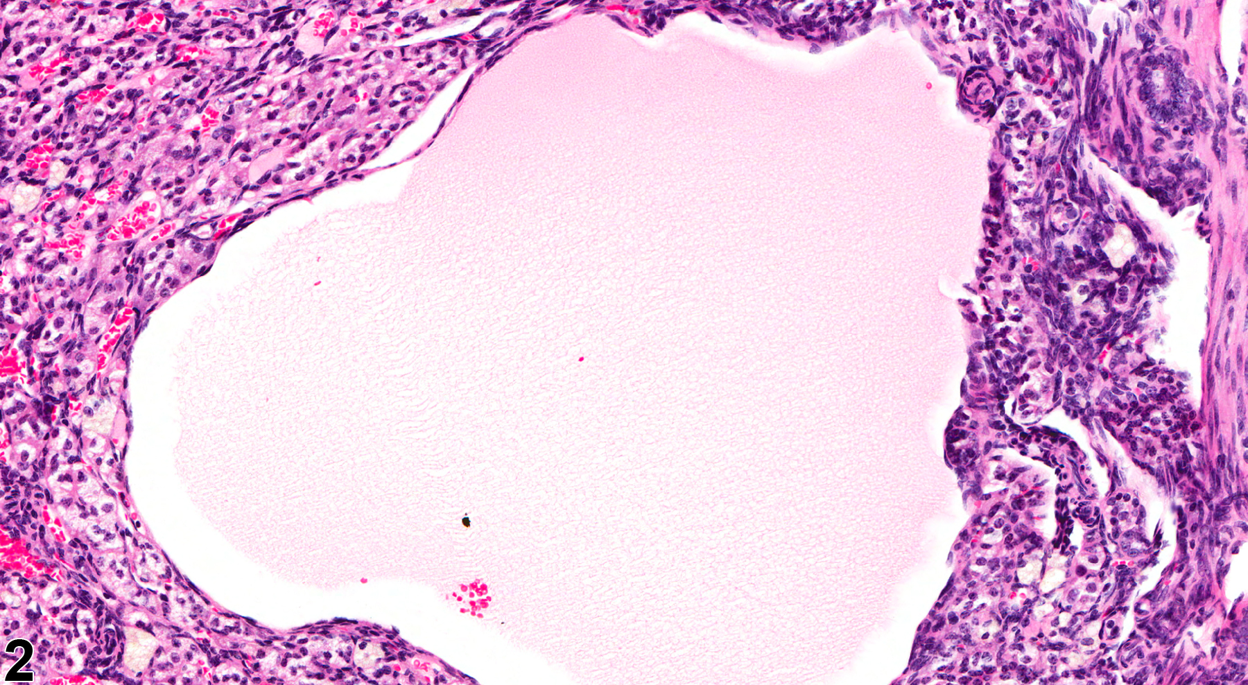 Image of cyst in the ovary from a female B6C3F1 mouse in a chronic study