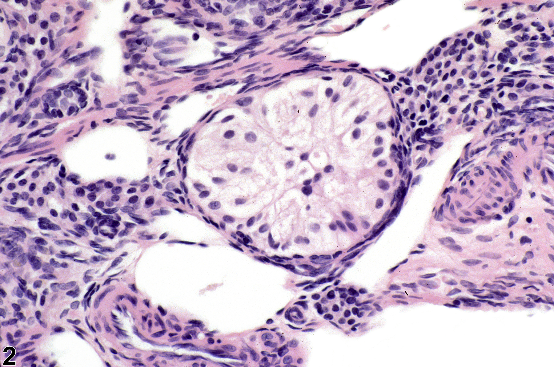 Image of hyperplasia, sertoliform in the ovary from a female F344/N rat in a chronic study