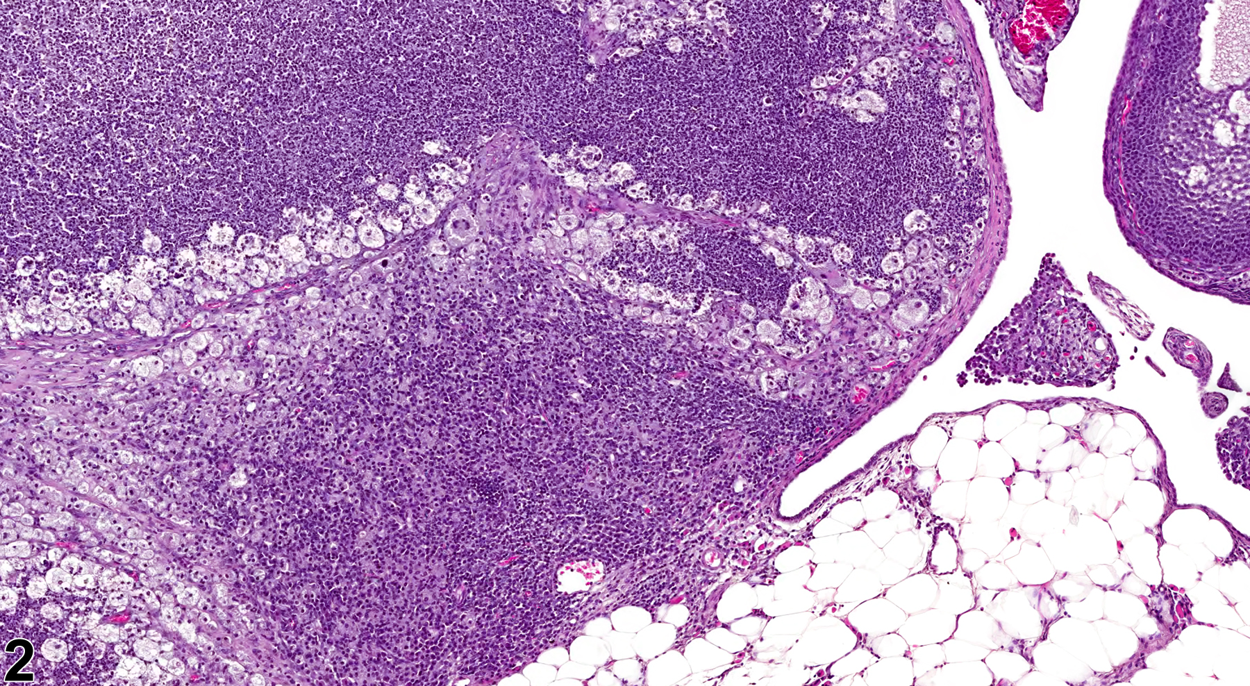Image of inflammation, suppurative in the ovary from a female B6C3F1 mouse in a chronic study