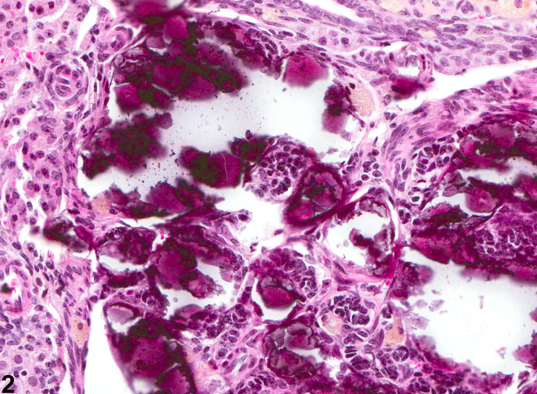 Image of mineral in the ovary from a female B6C3F1 mouse in a chronic study