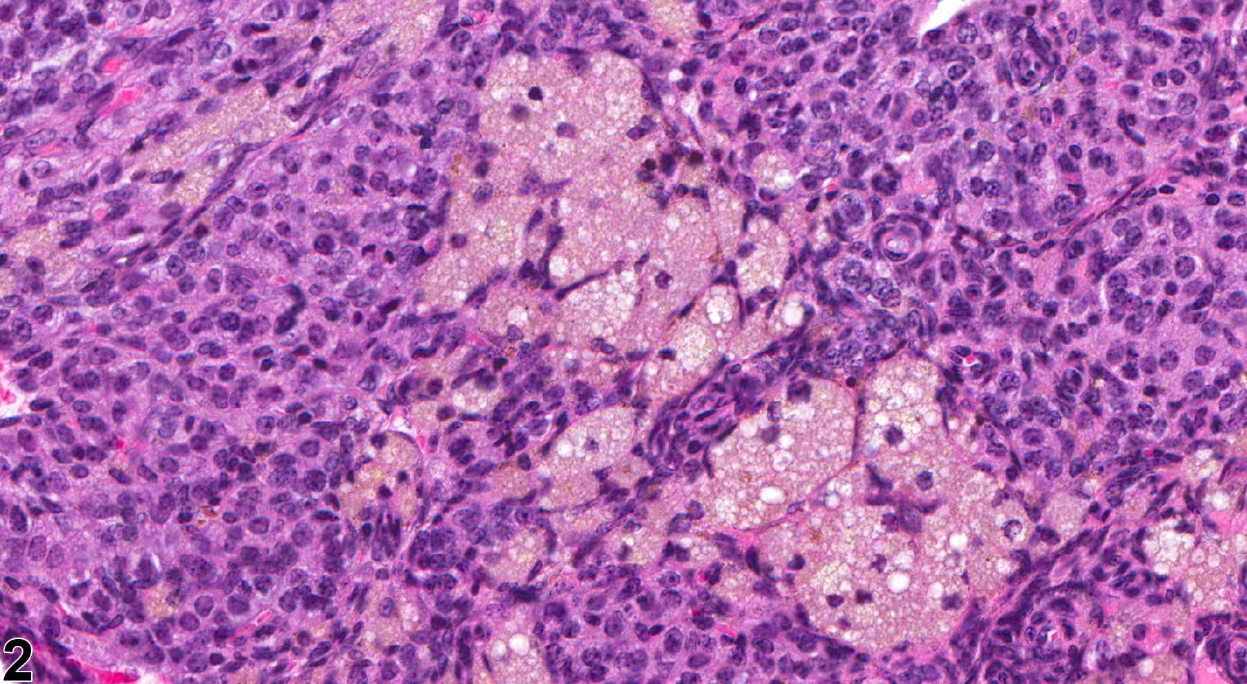 Image of pigment in the ovary from a female B6C3F1 mouse in a chronic study