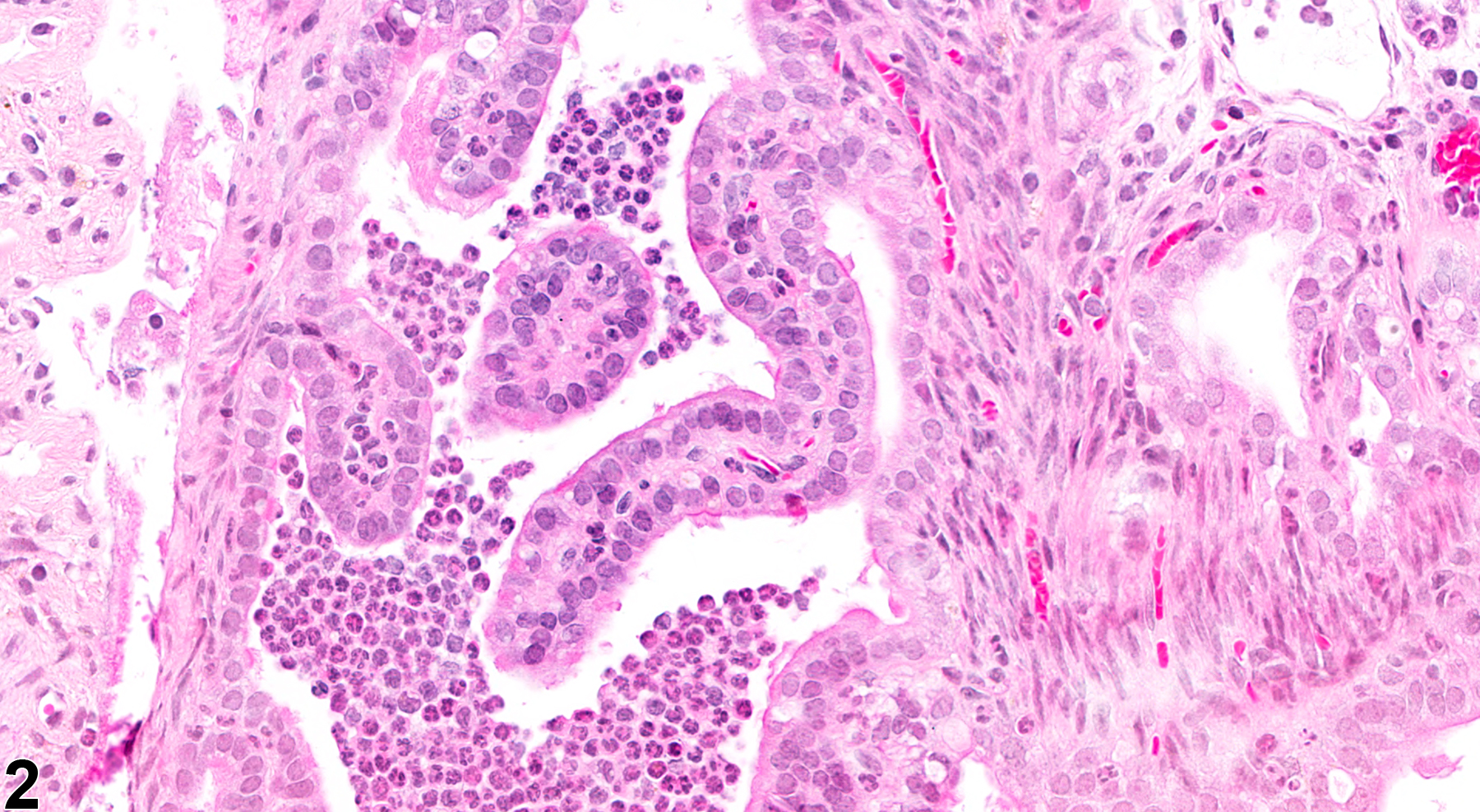 Image of inflammation in the oviduct from a female B6C3F1 mouse in a chronic study