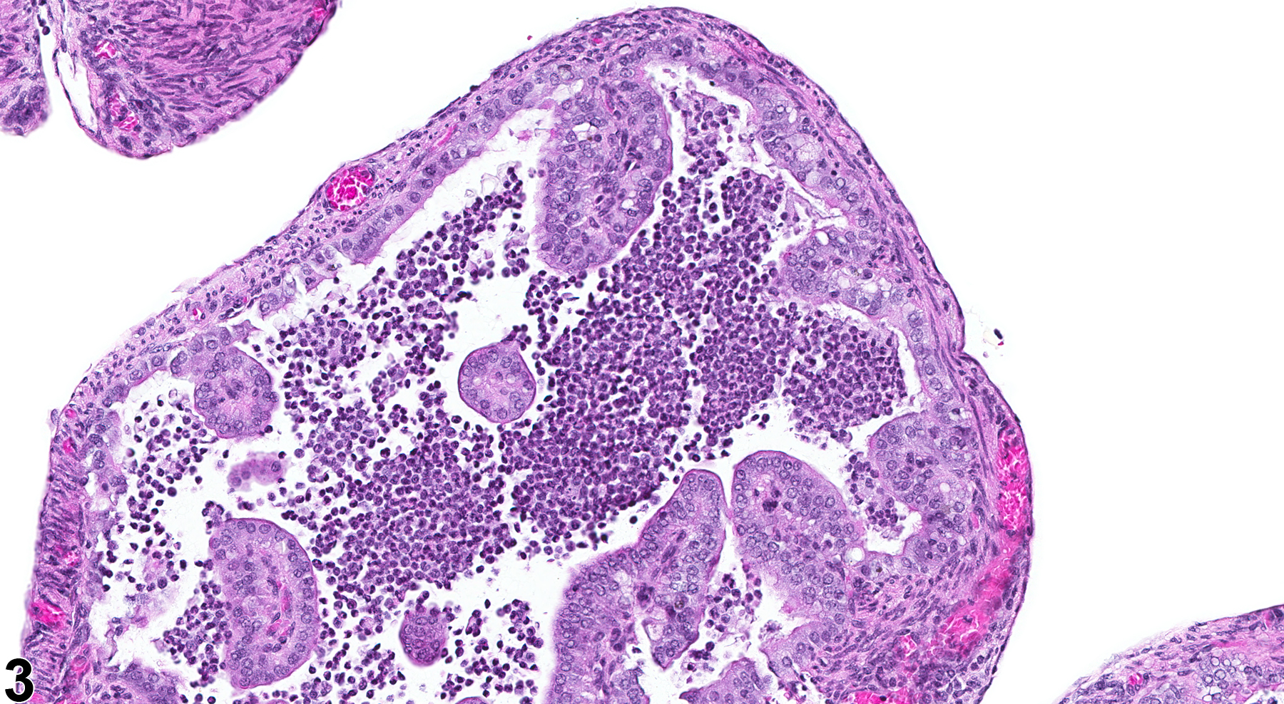 Image of inflammation in the oviduct from a female B6C3F1 mouse in a chronic study