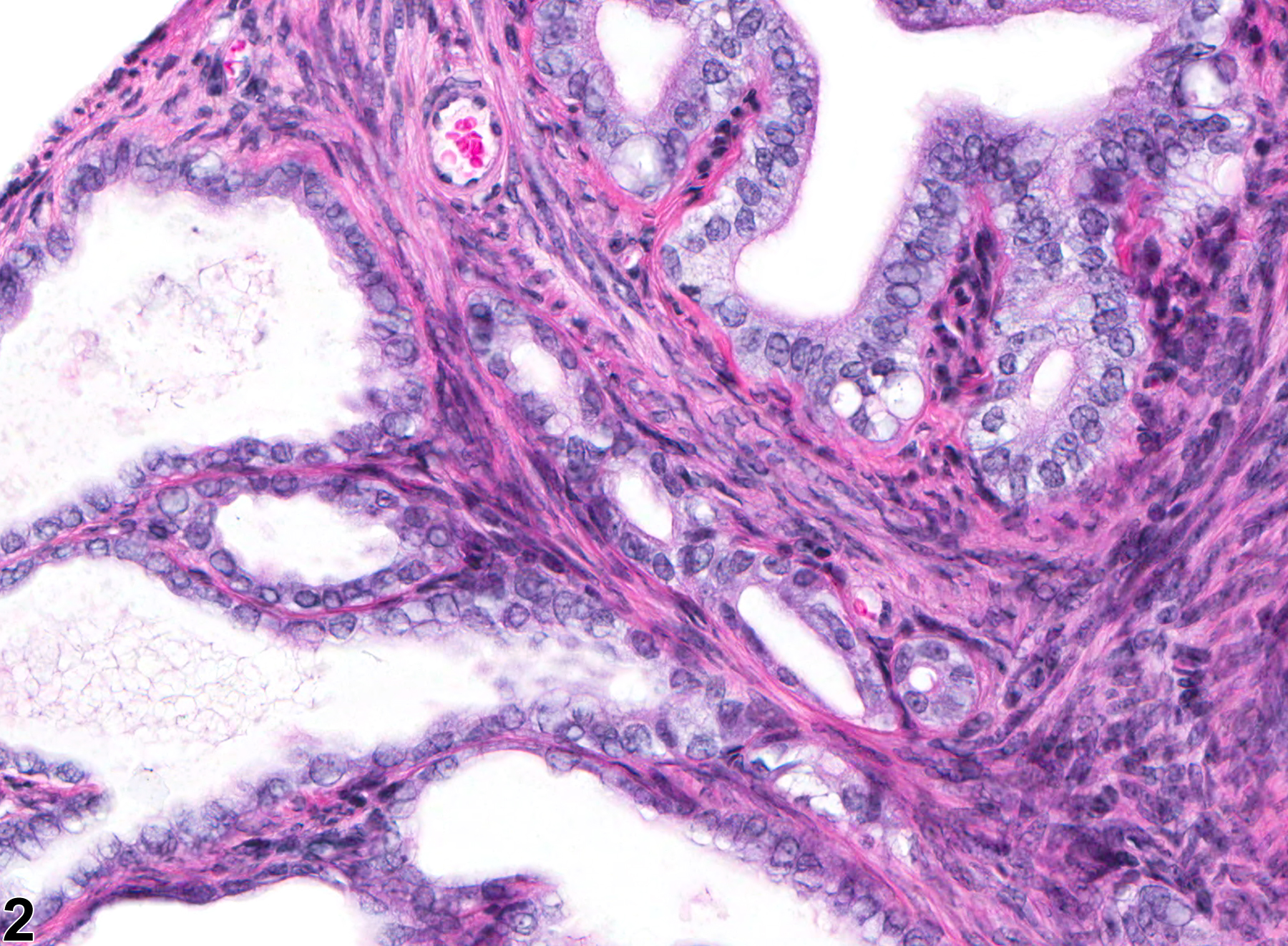 Image of mesonephric duct remnant in the oviduct from a female B6C3F1 mouse in a chronic study