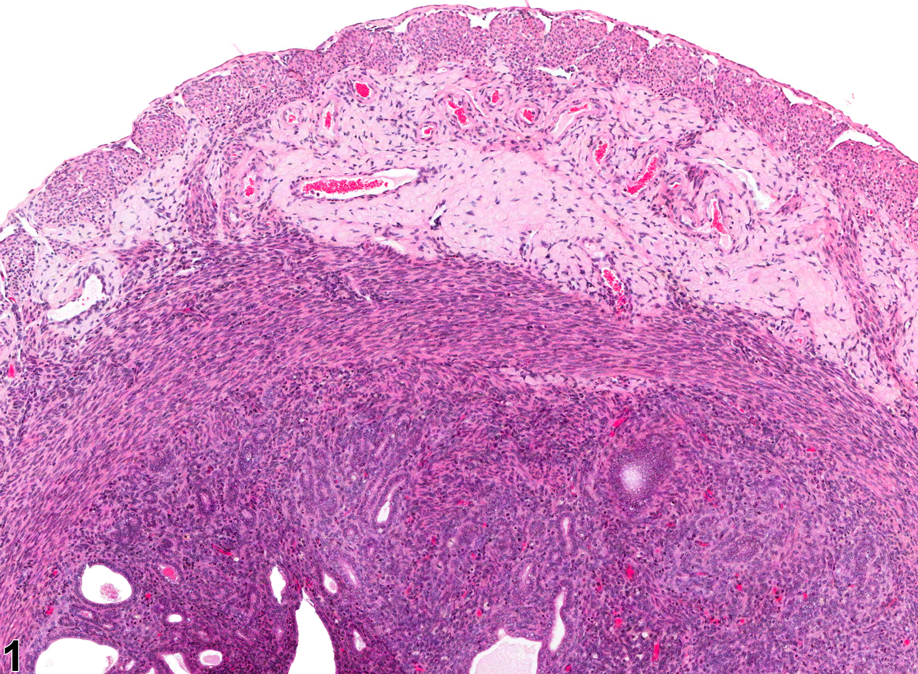 Image of amyloid in the uterus from a female Swiss Webster mouse in a chronic study