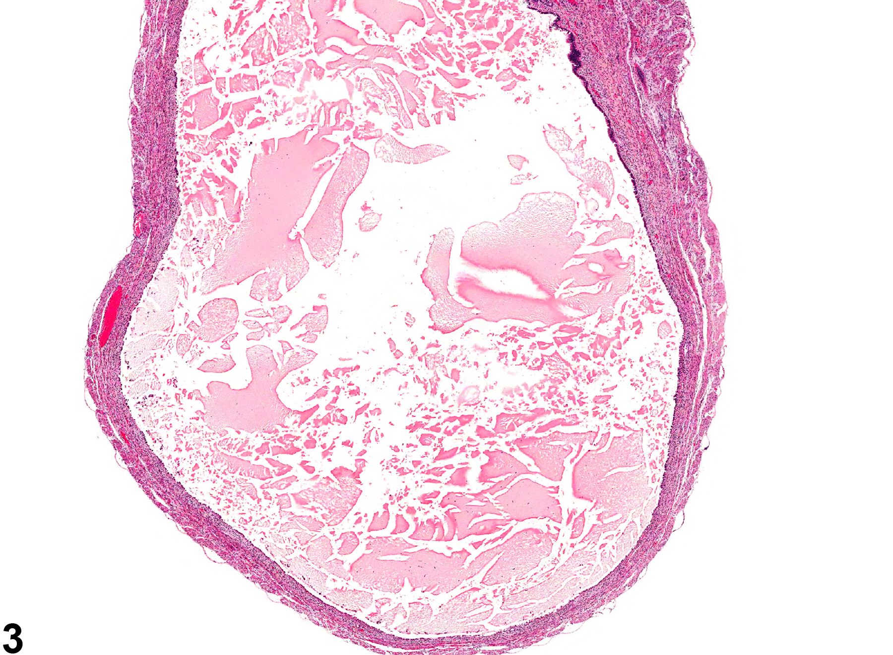 Image of dilation in the uterus from a female B6C3F1 mouse in a chronic study