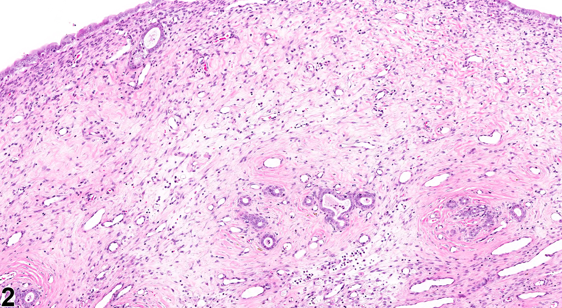 Image of edema in the uterus from a female F344/N rat in a chronic study