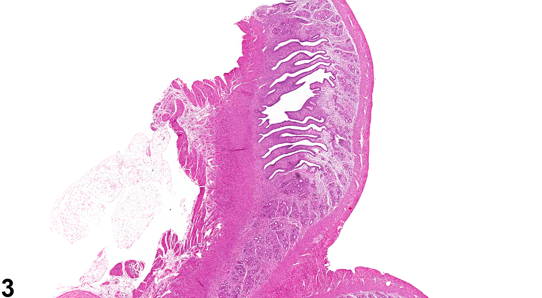 Image of edema in the uterus from a female B6C3F1 mouse in a chronic study