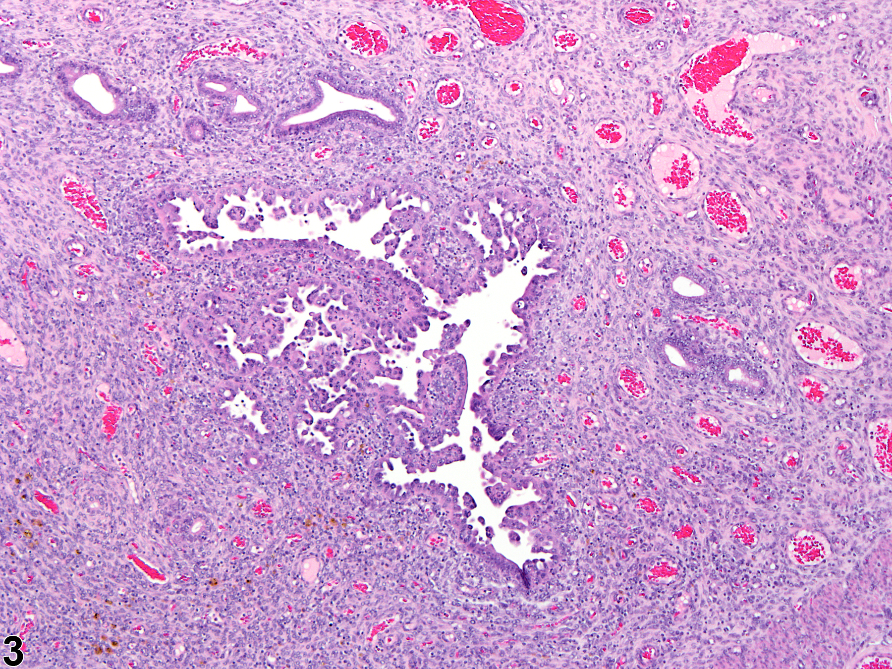 Image of hyperplasia, atypical in the uterus from a female Wistar Han rat in a chronic study