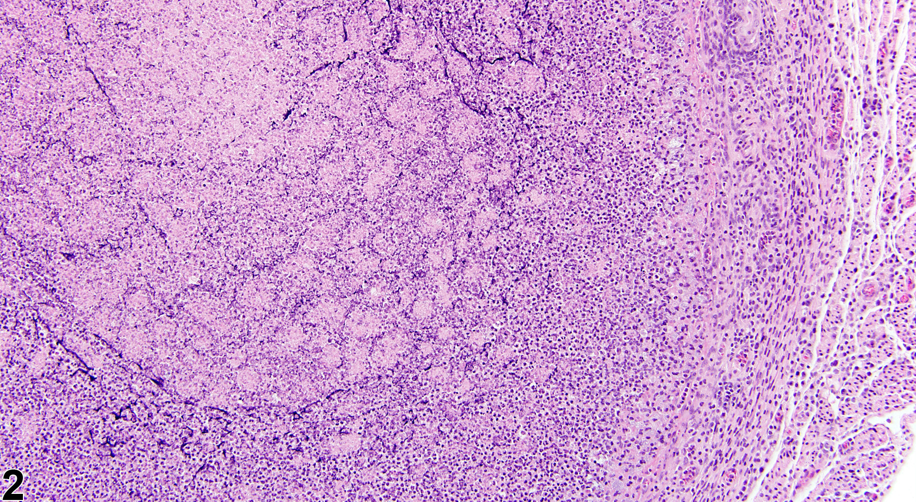 Image of inflammation, suppurative in the uterus from a female B6C3F1 mouse in a chronic study
