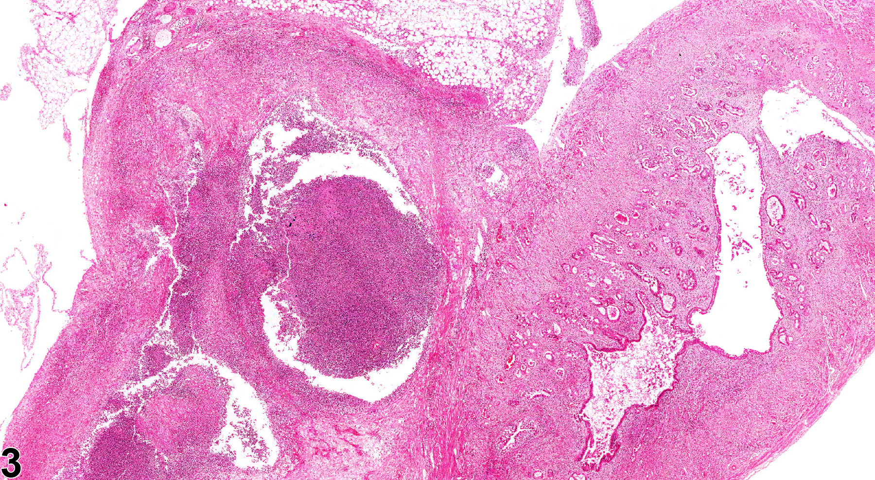 Image of inflammation, suppurative in the uterus from a female B6C3F1 mouse in a chronic study