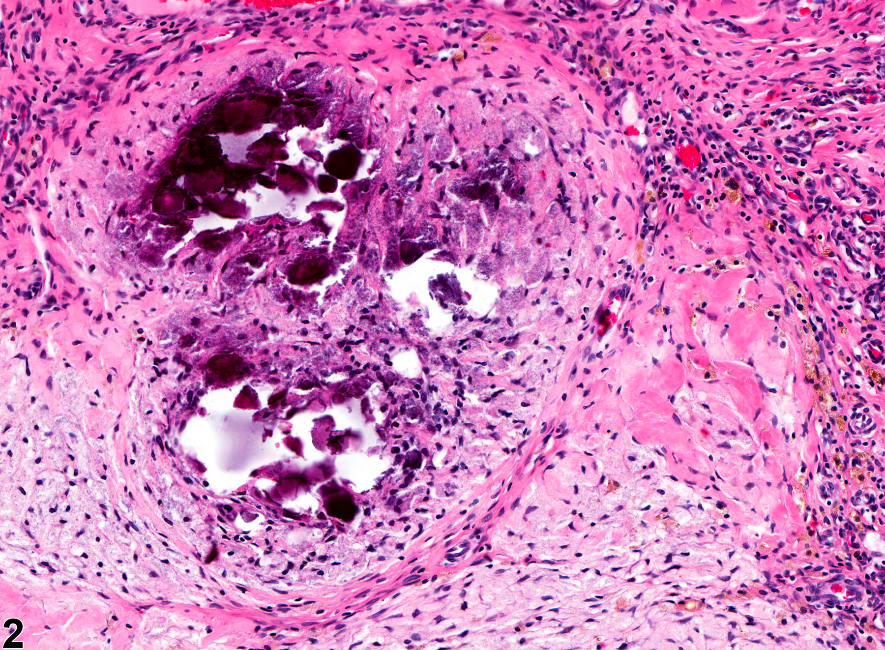 Image of necrosis in the uterus from a female F344/N rat in a chronic study