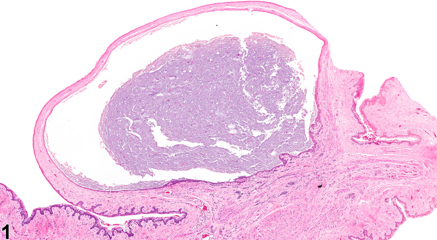 Image of cyst in the vagina from a female F344/N rat in a chronic study