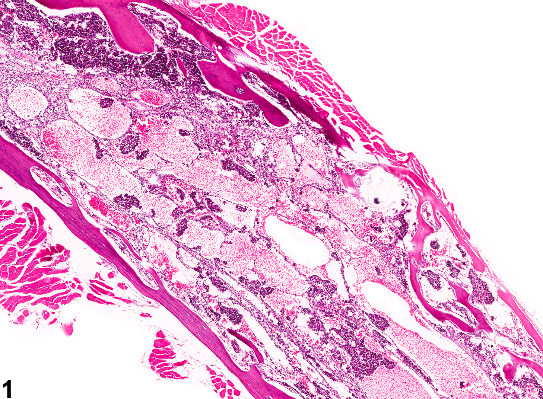 Image of angiectasis in the bone marrow from a female B6C3F1 mouse in a chronic study