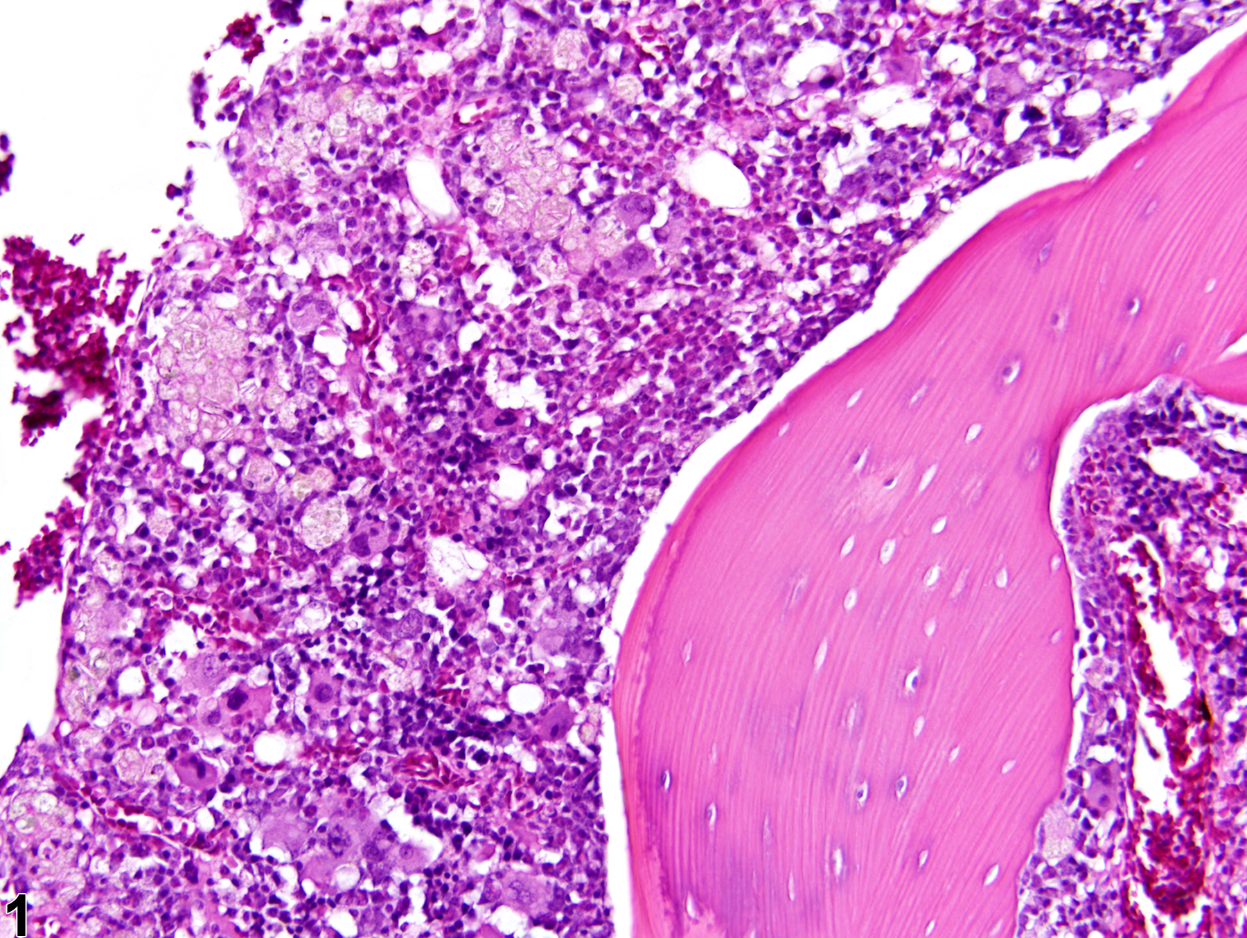 Image of infiltration cellular, histiocyte in the bone marrow from a female F344/N rat in a 2 year study