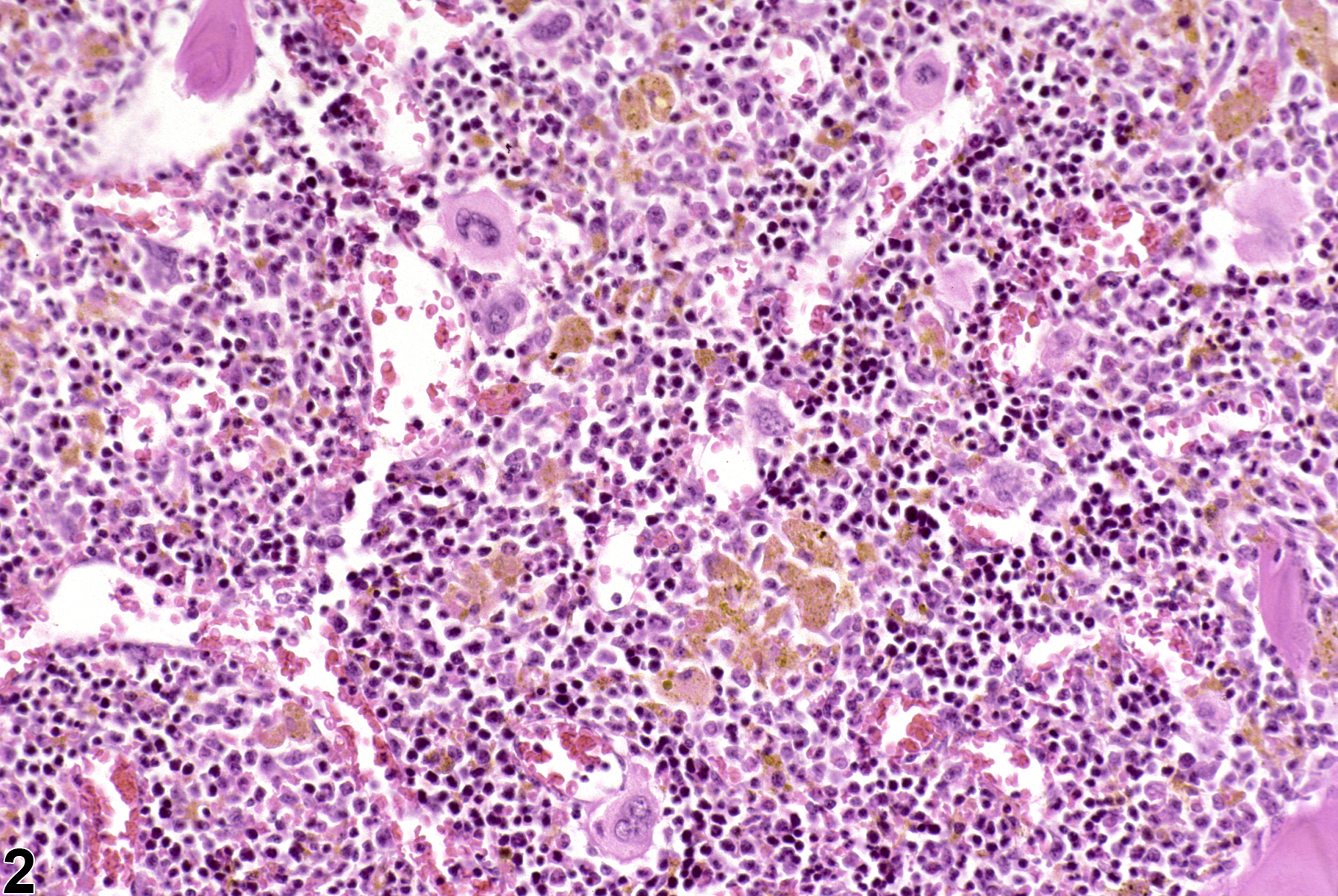 Image of pigment in the bone marrow from a male B6C3F1 mouse in a chronic study