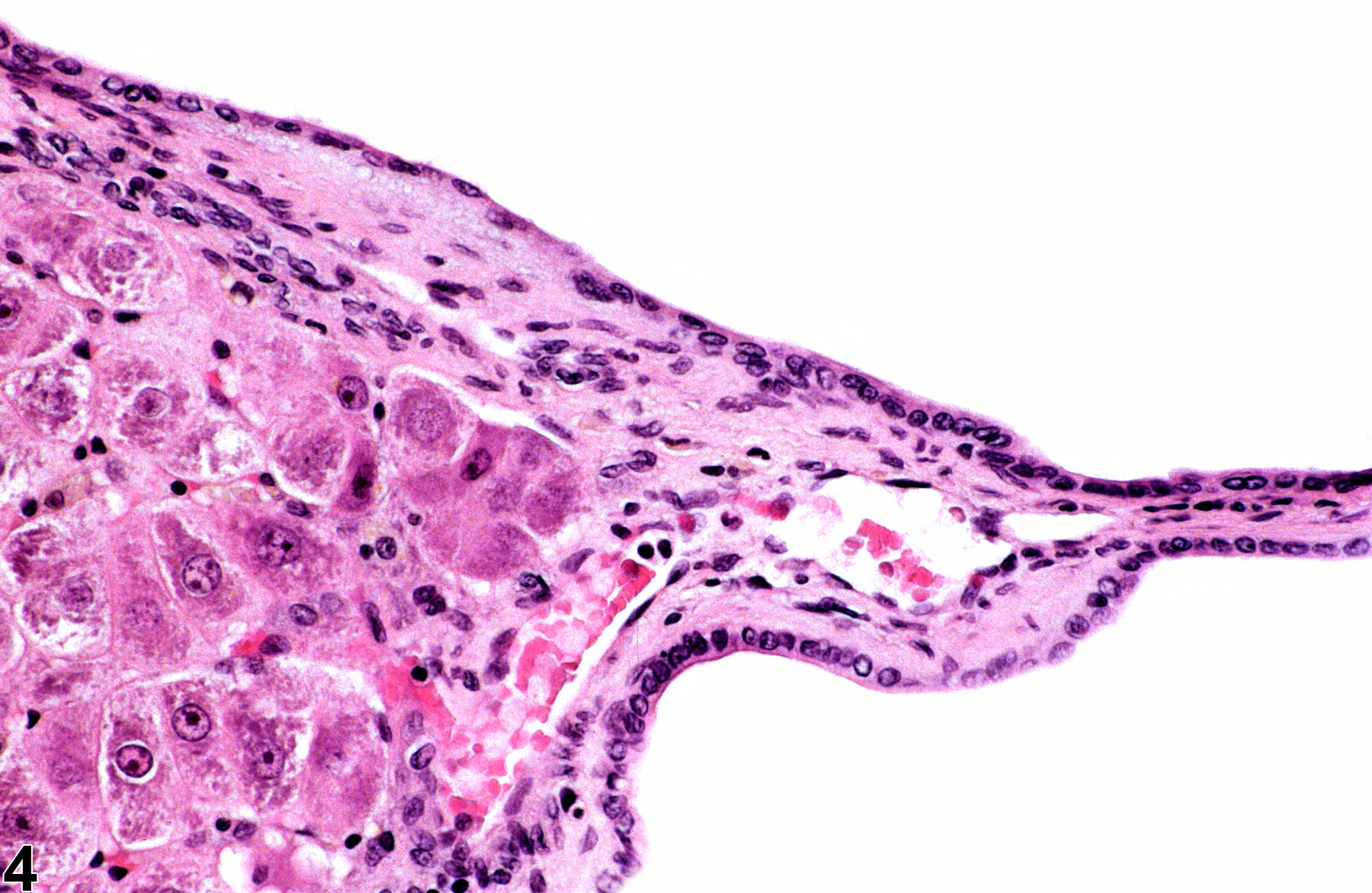 Image of cyst in the liver bile duct from a female Harlan Sprague-Dawley rat in a chronic study
