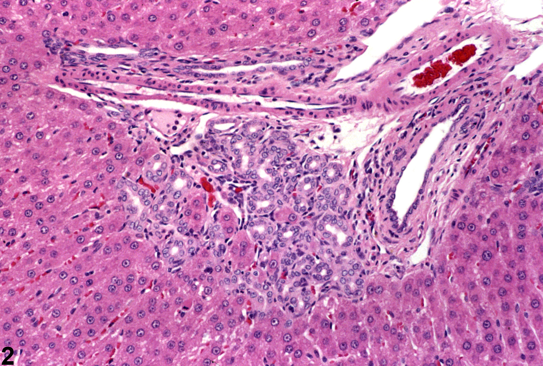 Image of hyperplasia in the liver bile duct from a female F344/N rat in a subchronic study