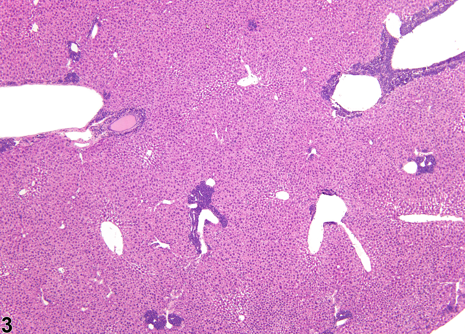 Image of extramedullary hematopoiesis in the liver from a male  B6C3F1 mouse in a chronic study