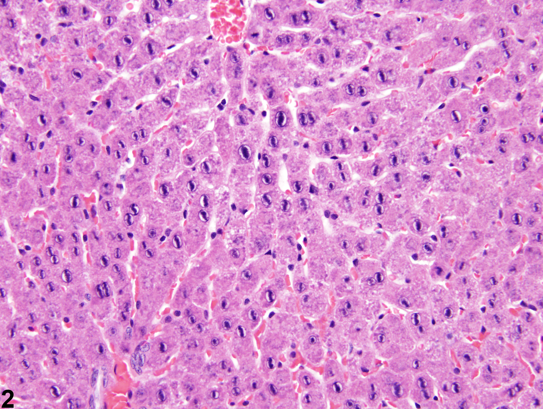 Image of hepatodiaphragmatic nodule in the liver from a female F344/N rat in a subchronic study