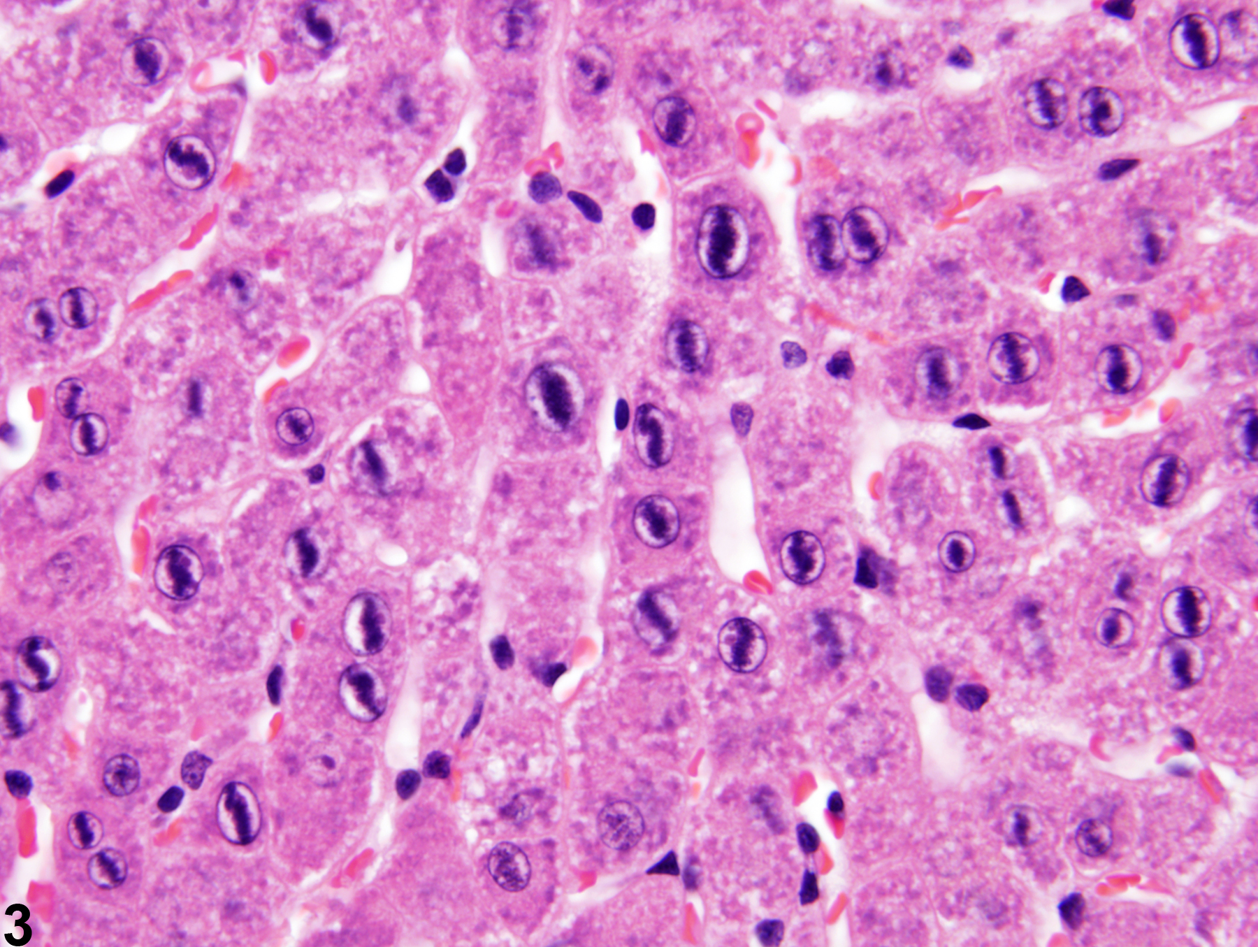Image of hepatodiaphragmatic nodule in the liver from a female F344/N rat in a subchronic study
