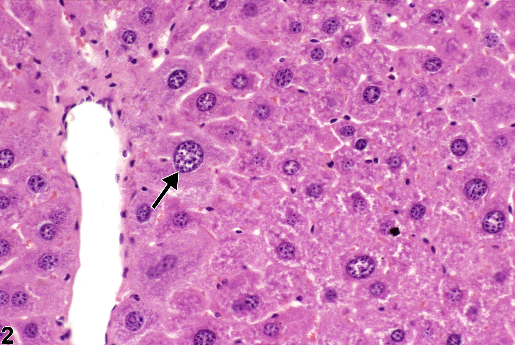 Image of karyomegaly in the liver from a male  B6C3F1 mouse in a subchronic study