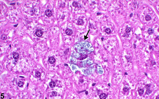 Image of hematoxylin crystals deposited within hepatocytes during staining with unfiltered hematoxylin staining solution in the liver