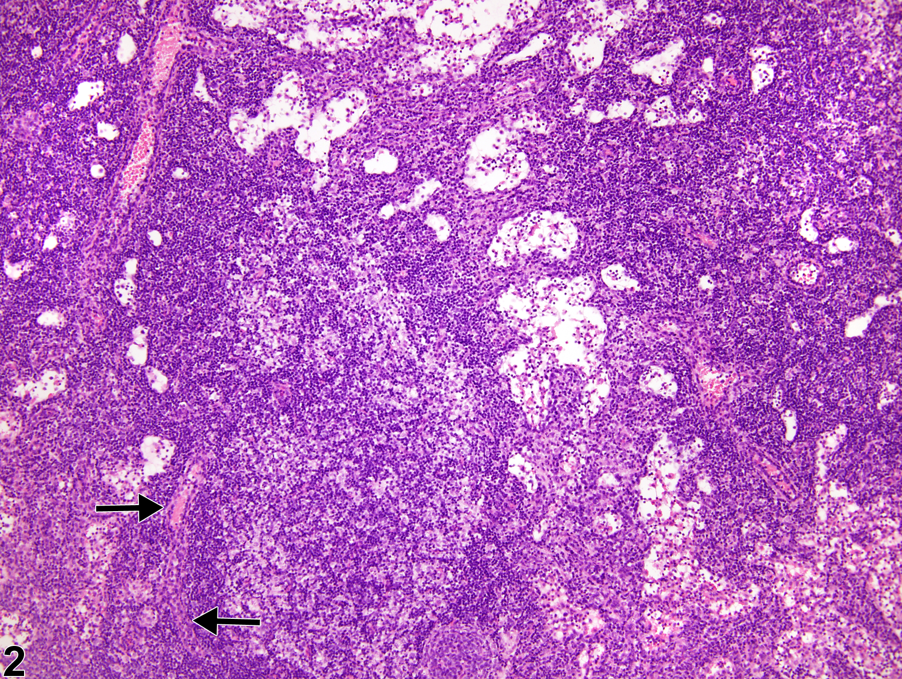 Image of atrophy in the lymph node from a female F344/N rat in a subchronic study