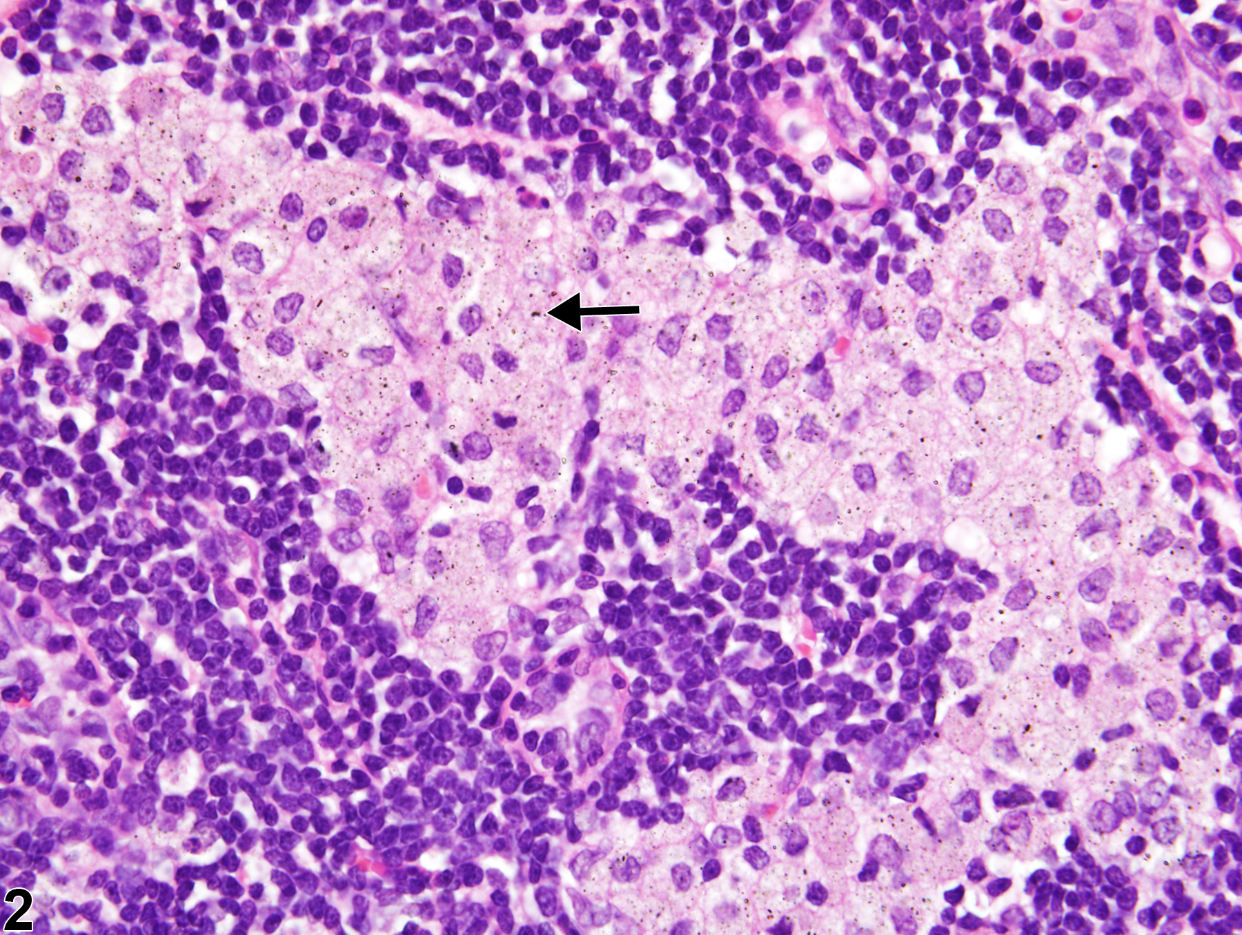 Image of infiltrate, cellular, histiocyte in the lymph node from a male Harlan Sprague-Dawley rat in a subchronic study