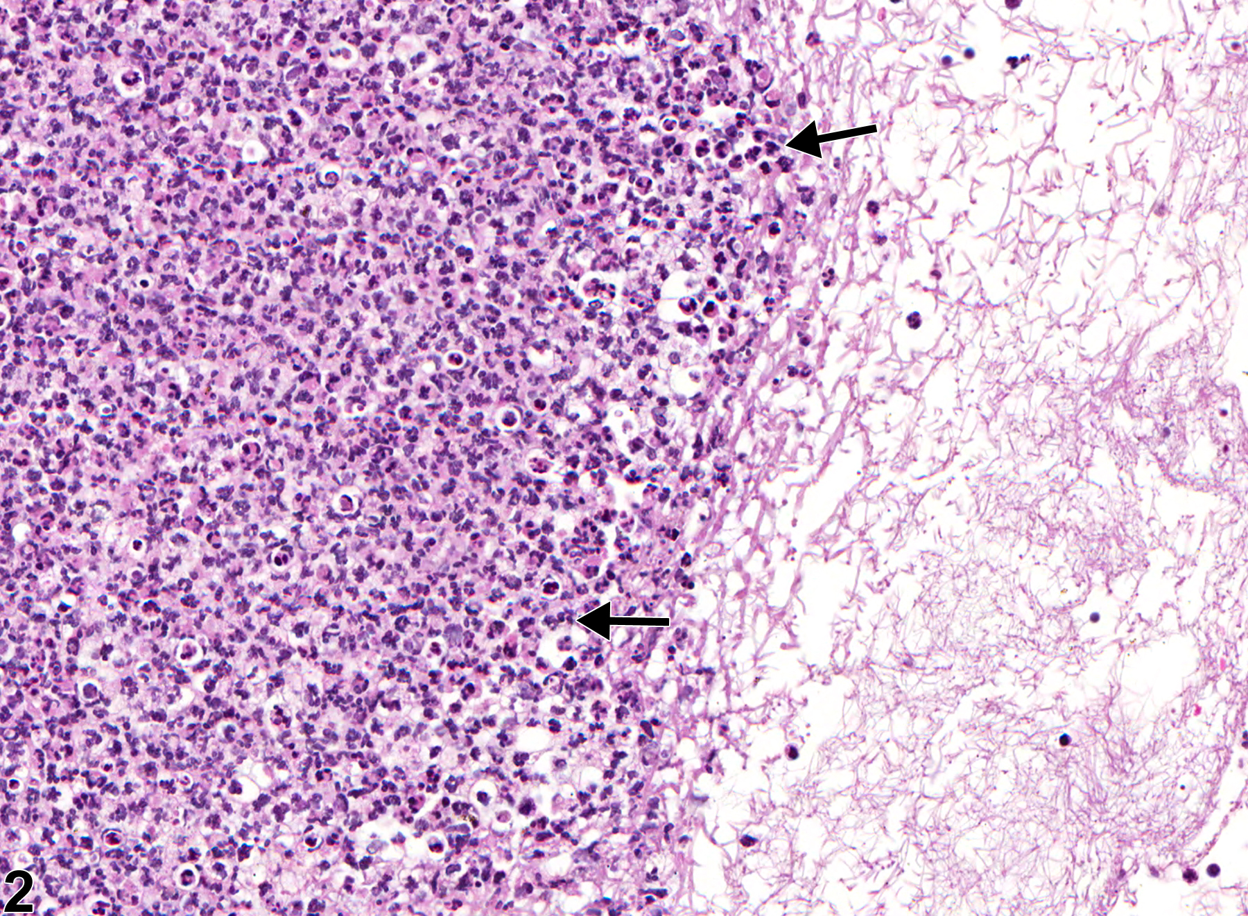 Image of inflammation in the lymph node from a male F344/N rat in a chronic study