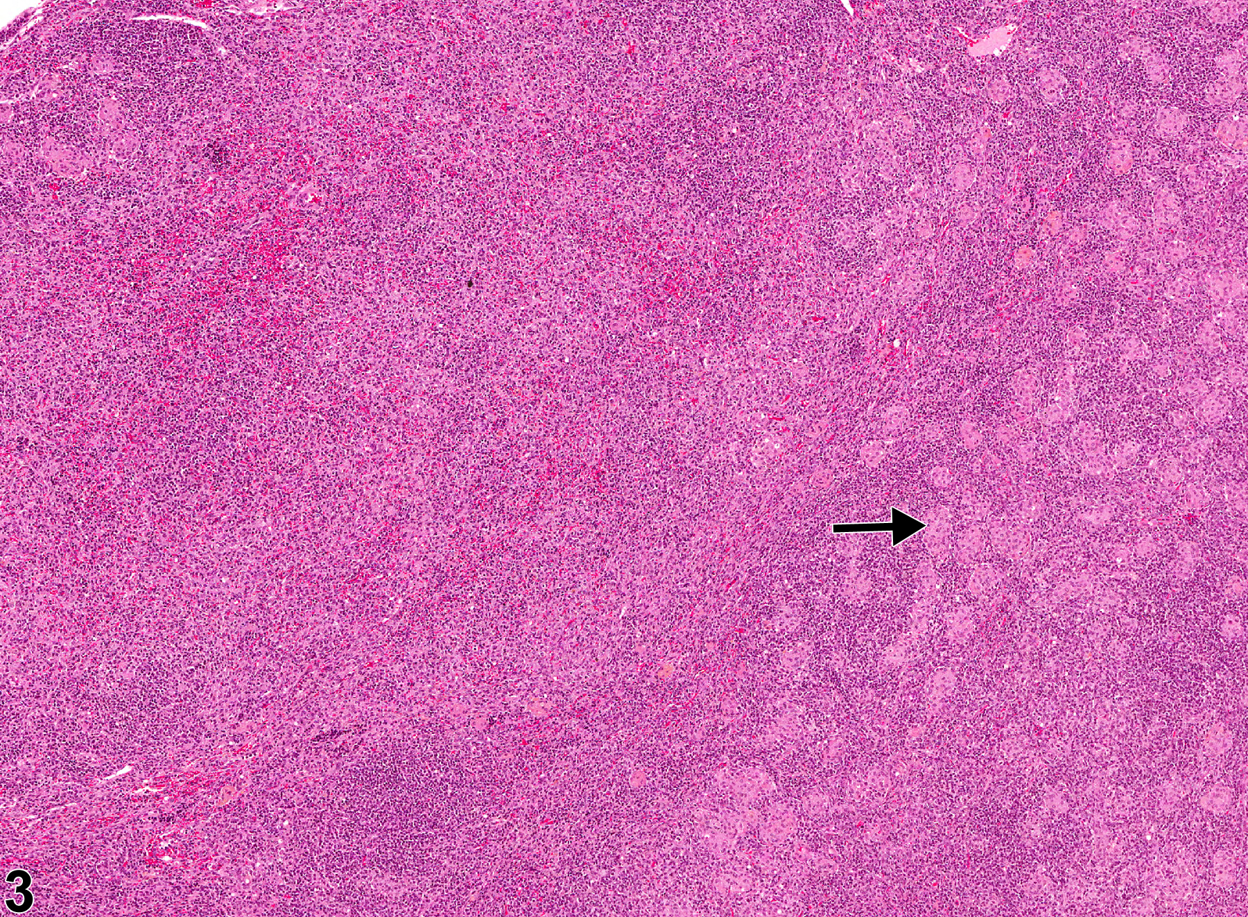 Image of inflammation in the lymph node from a female F344/N rat in a chronic study