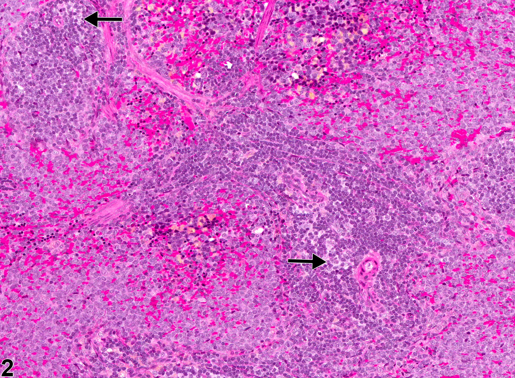 Image of atrophy in the spleen from a female F344/N rat in a subchronic study