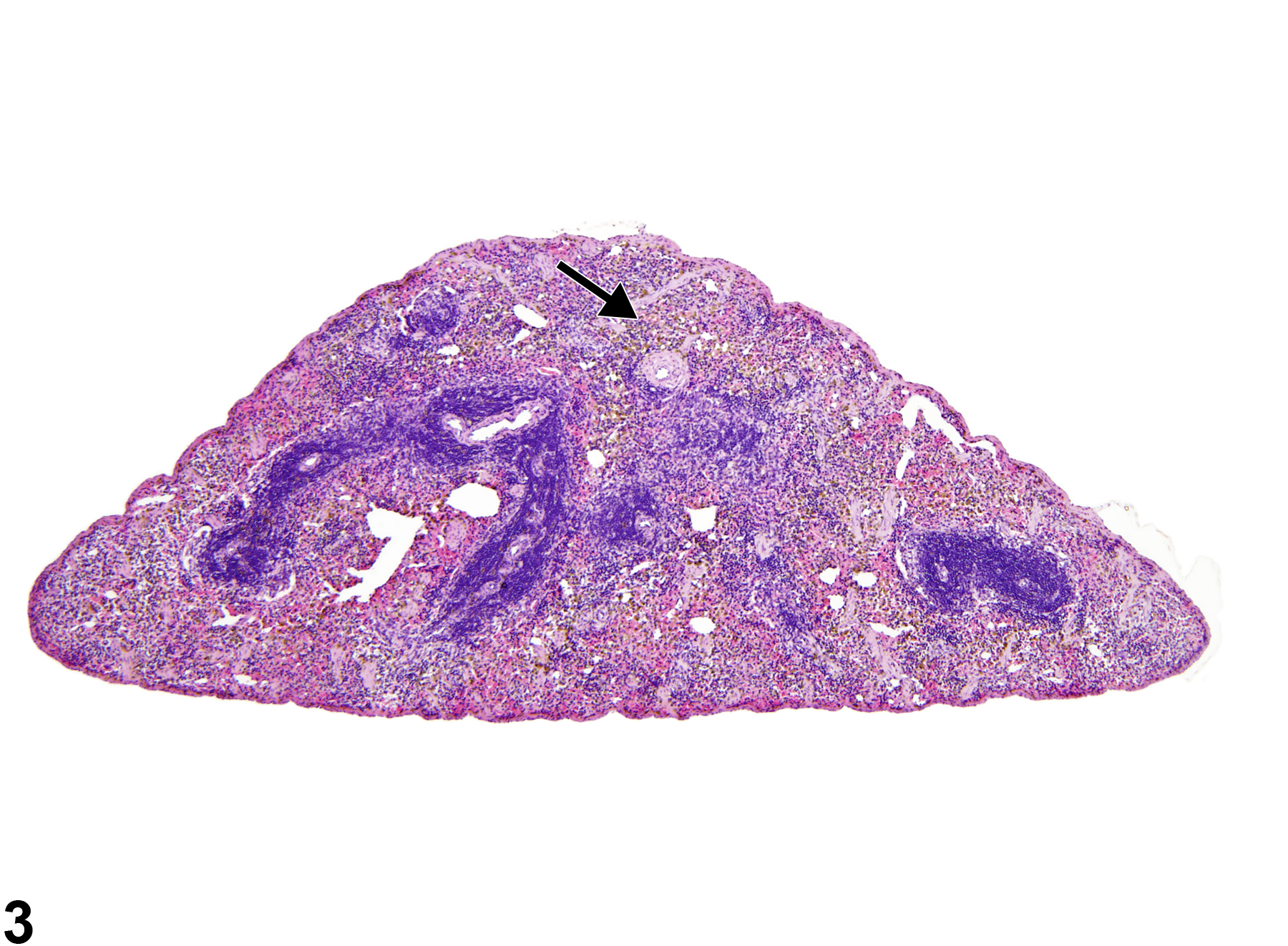 Image of atrophy in the spleen from a female B6C3F1/N mouse in a subchronic study