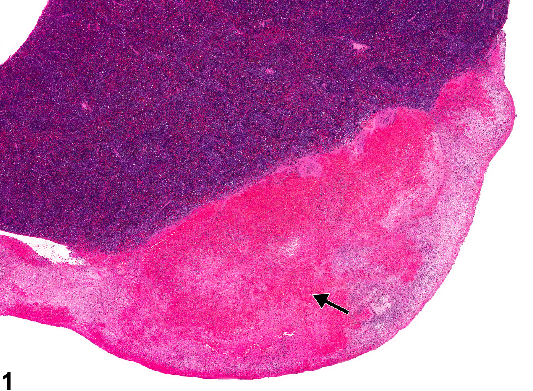 Image of hemorrhage in the spleen from a female Harlan Sprague-Dawley rat in a chronic study