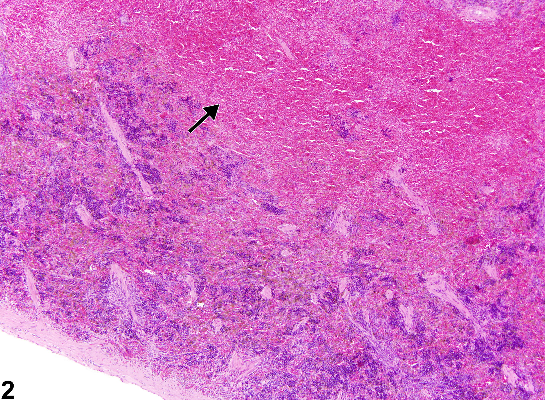 Image of hemorrhage in the spleen from a female F344/N rat in a chronic study