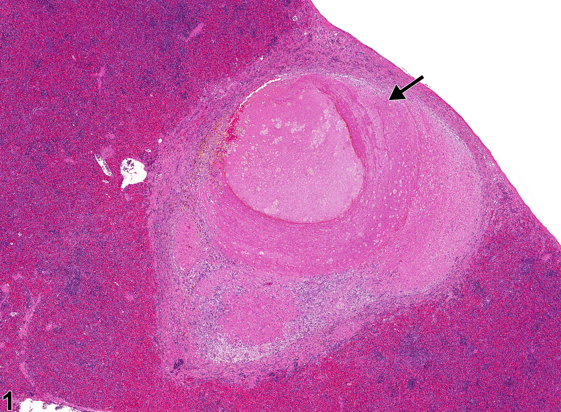 Image of necrosis in the spleen from a male F344/N rat in a chronic study