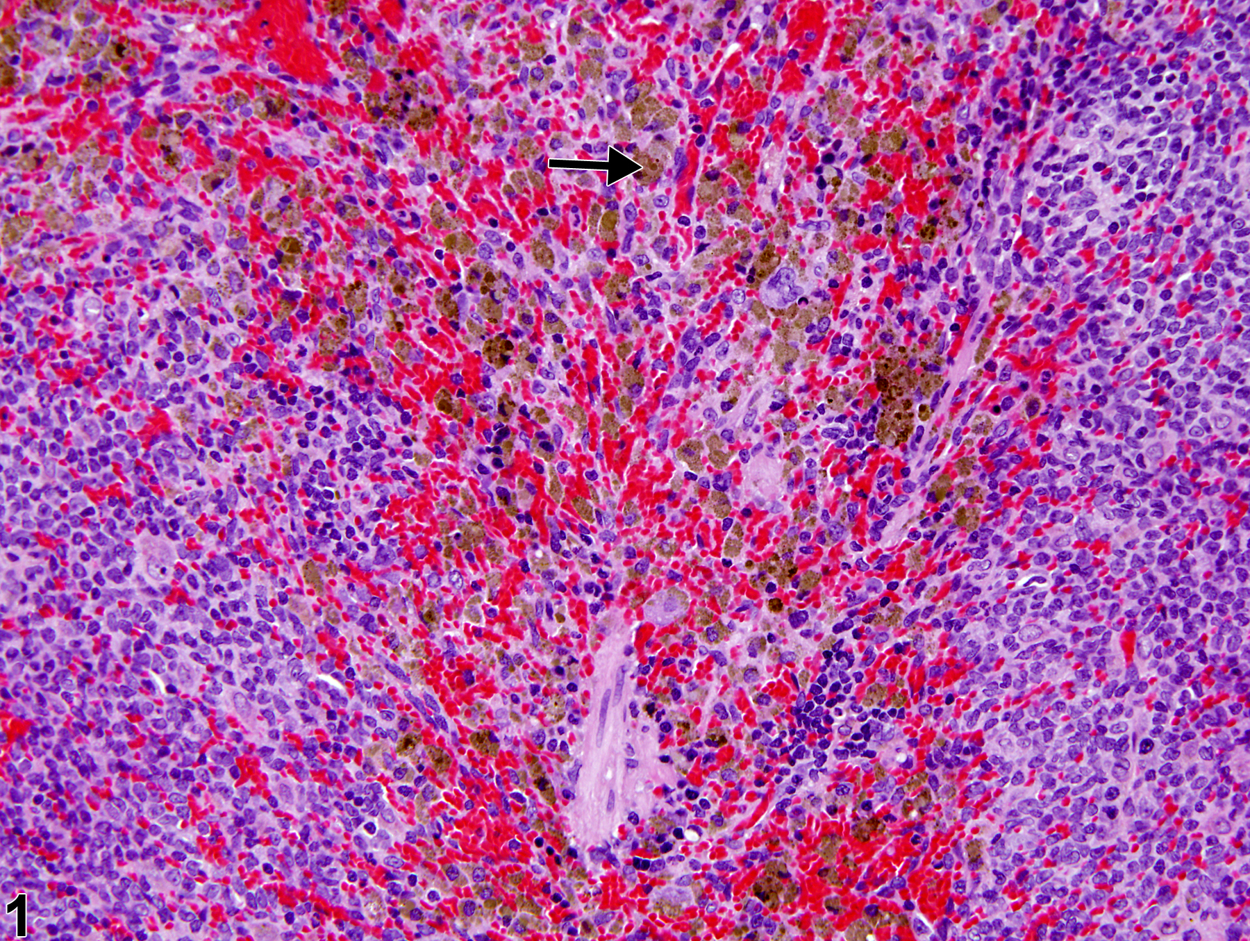 Image of pigment in the spleen from a male F344/N rat in a chronic study