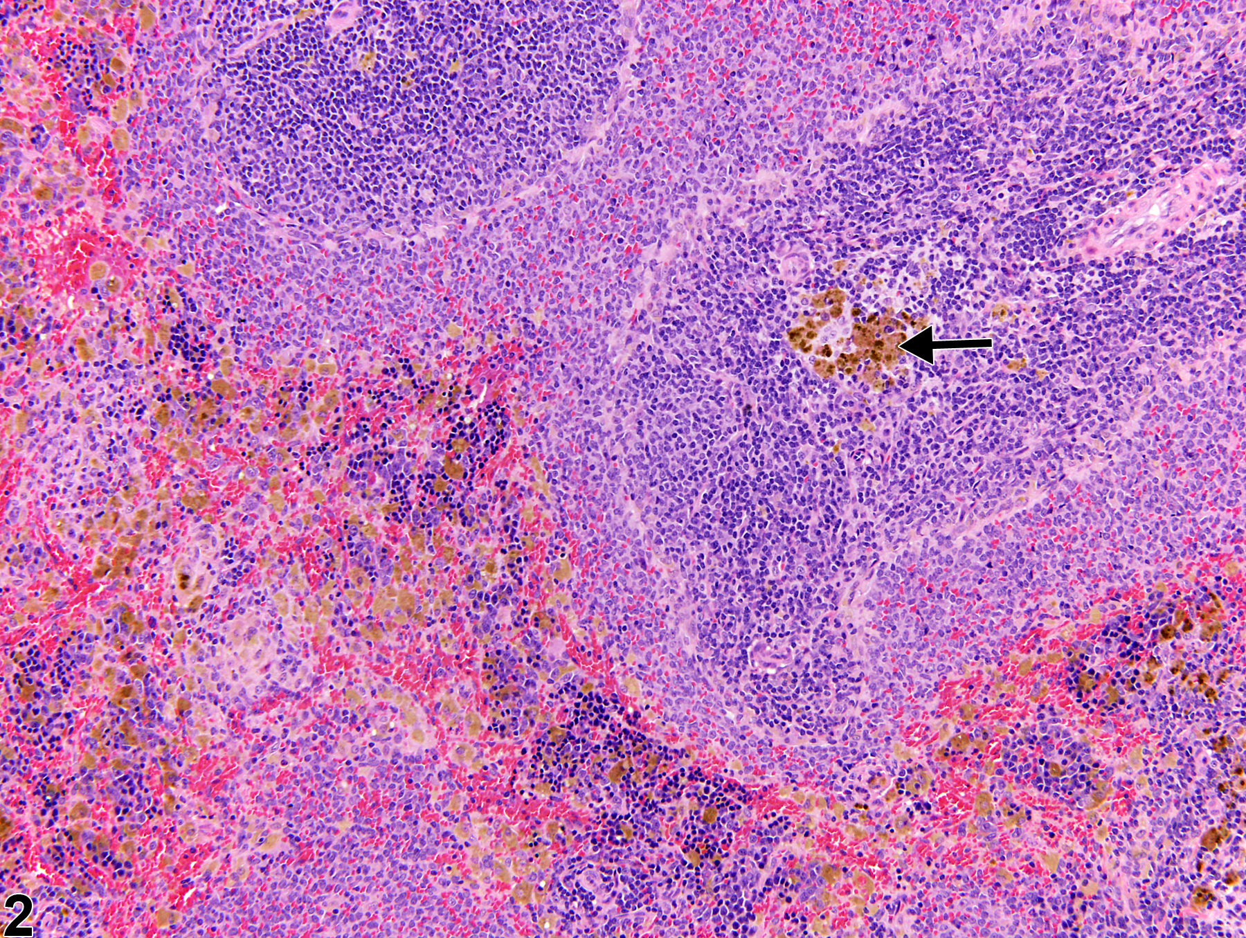 Image of pigment in the spleen from a female Harlan Sprague-Dawley rat in a chronic study