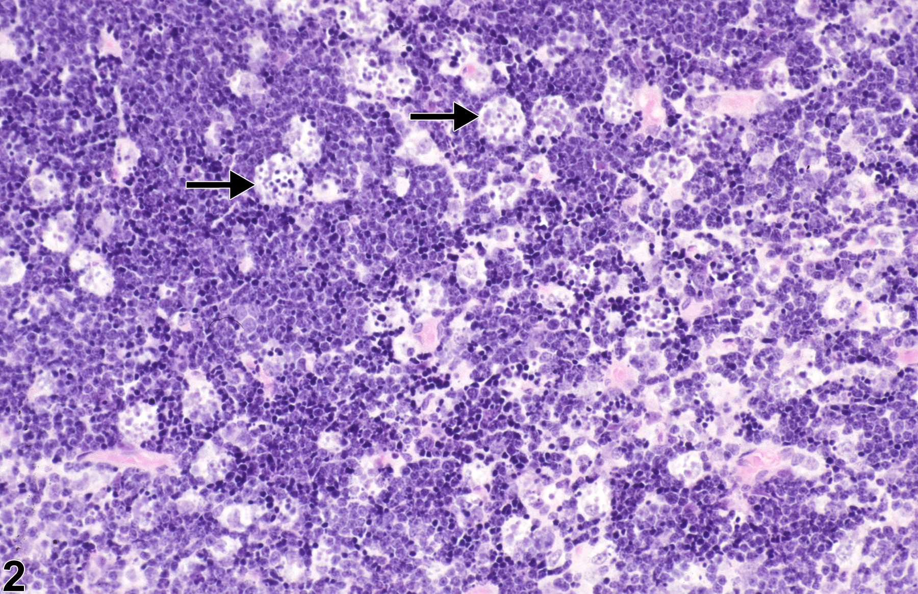Image of apoptosis, lymphocyte in the thymus from a female B6C3F1/N mouse in a subchronic study