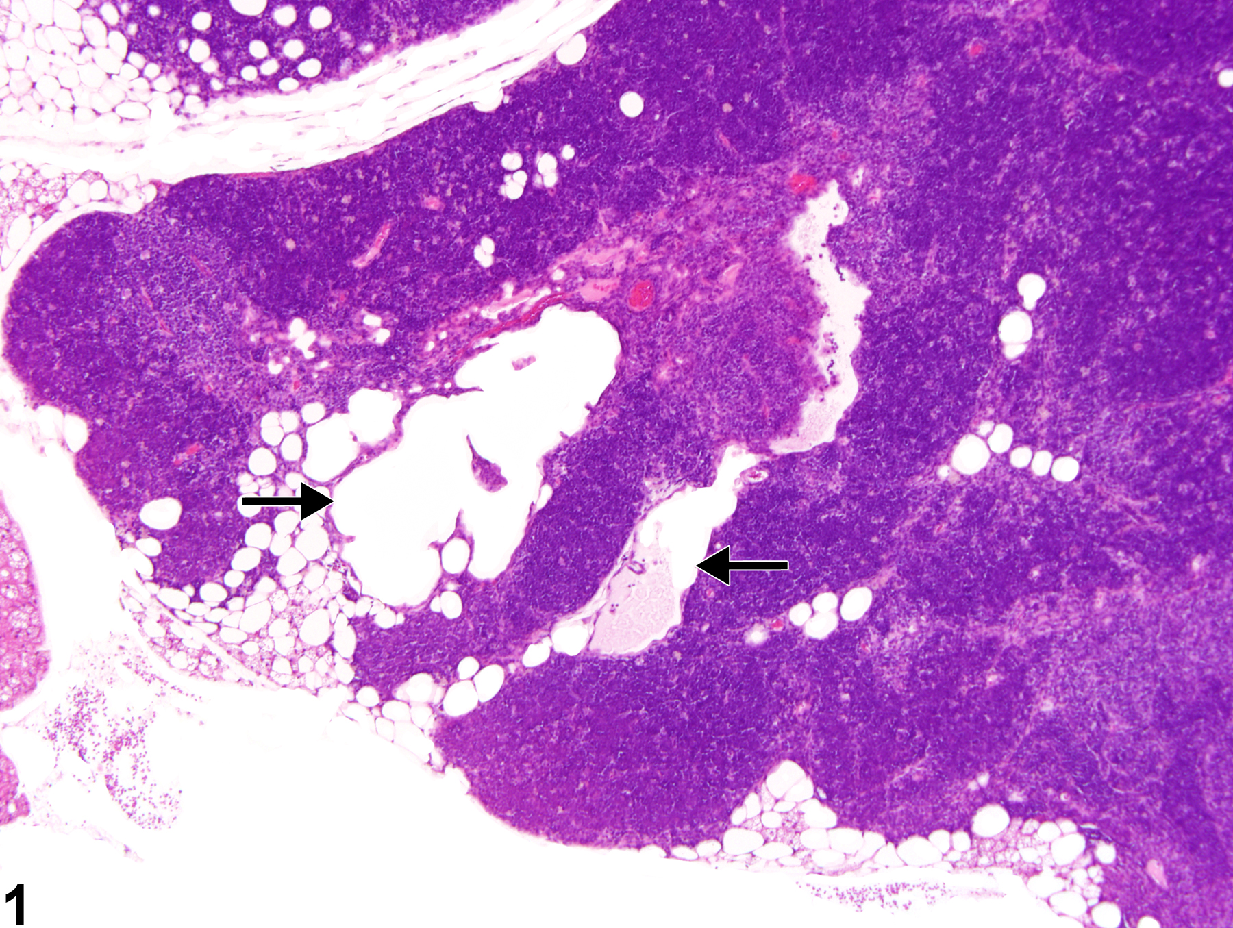 Image of cyst in the thymus from a female F344/N rat in a chronic study