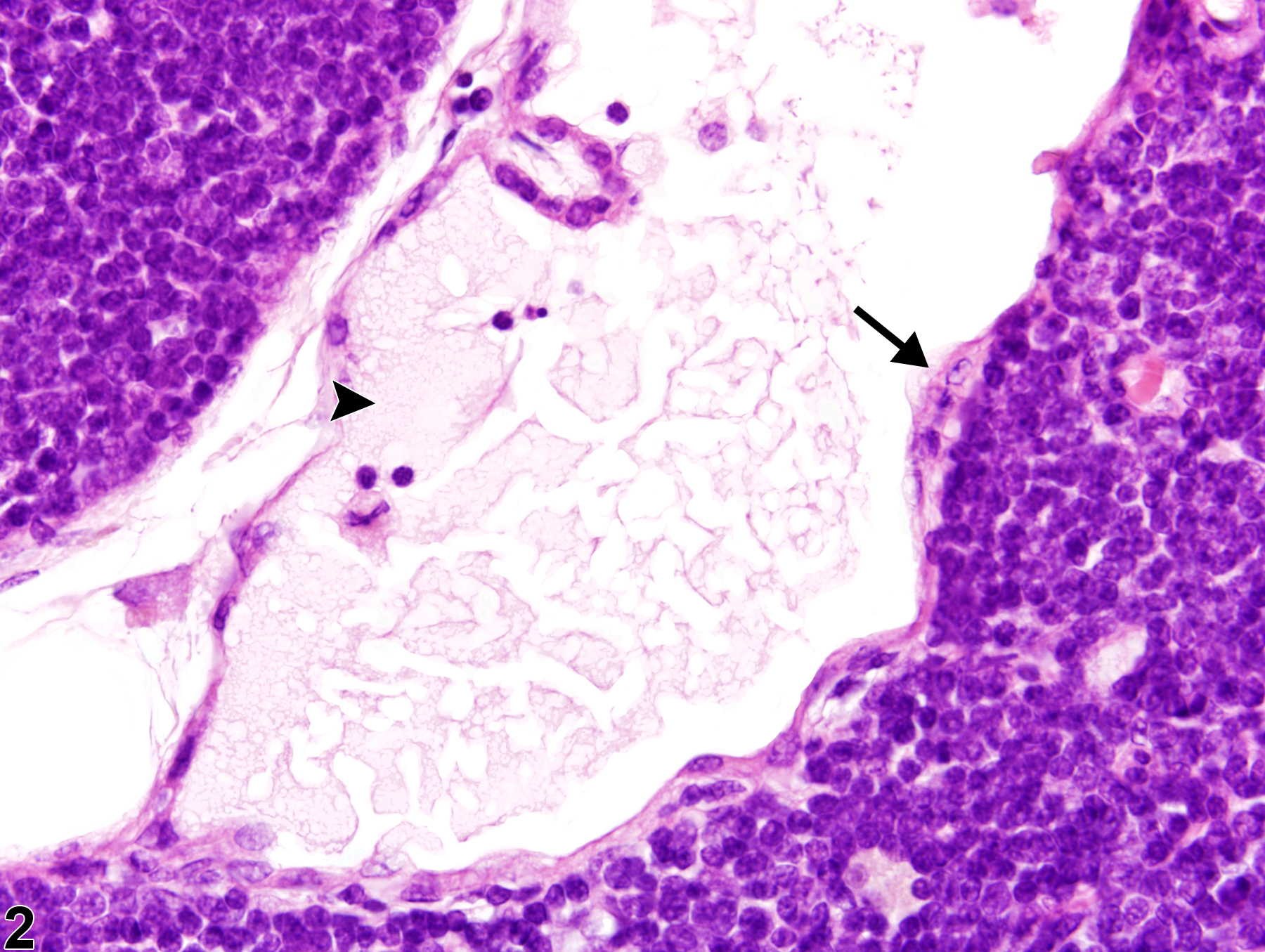 Image of cyst in the thymus from a female F344/N rat in a chronic study