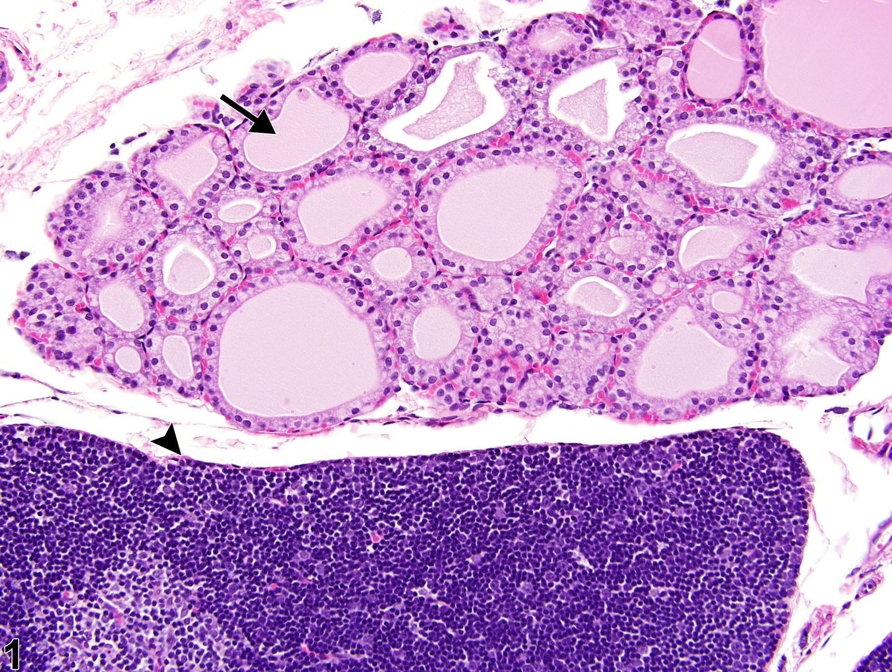Image of ectopic tissue in the thymus from a male Harlan Sprague-Dawley rat in a subchronic study