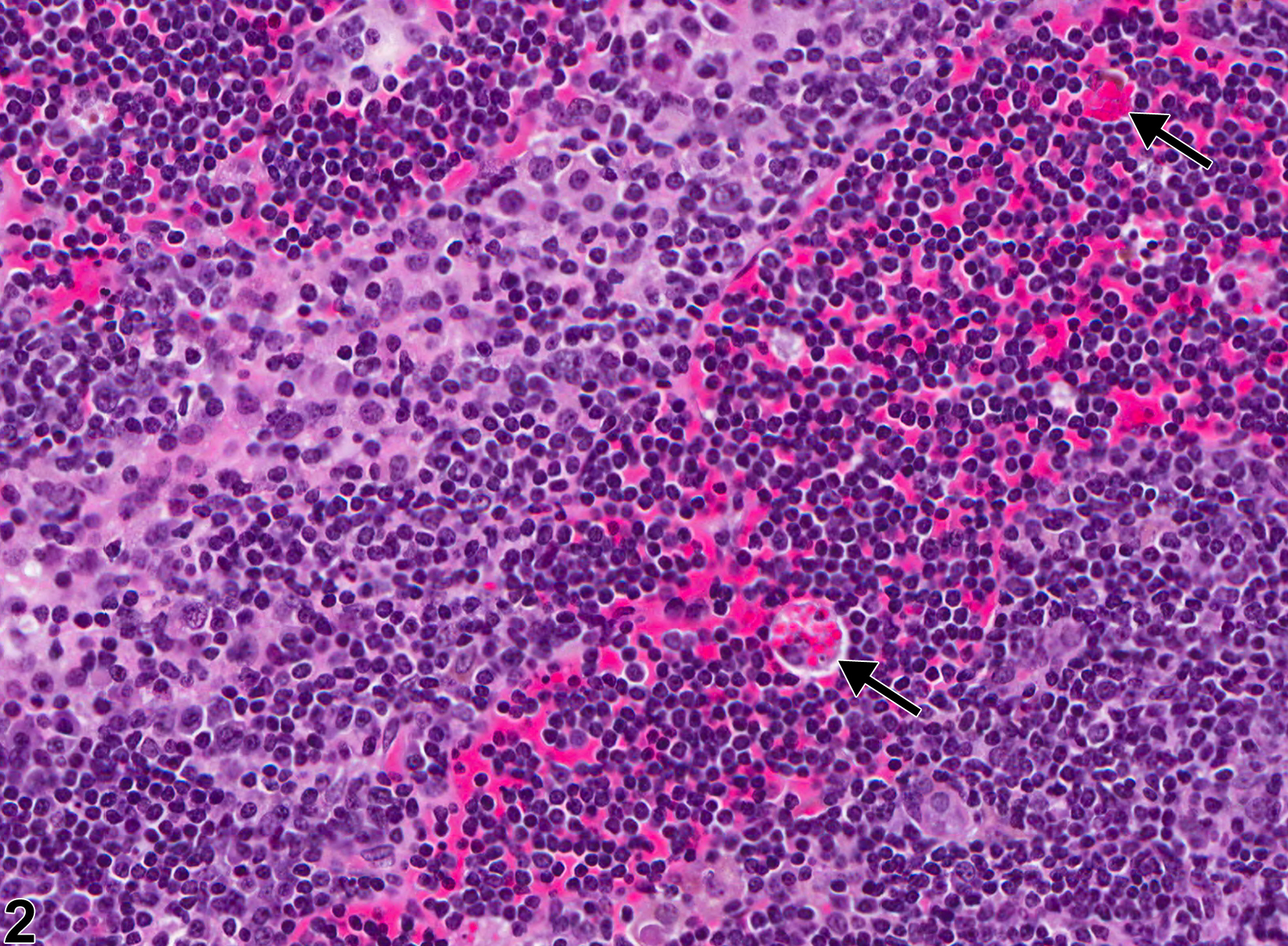 Image of hemorrhage in the thymus from a female B6C3F1/N mouse in a chronic study