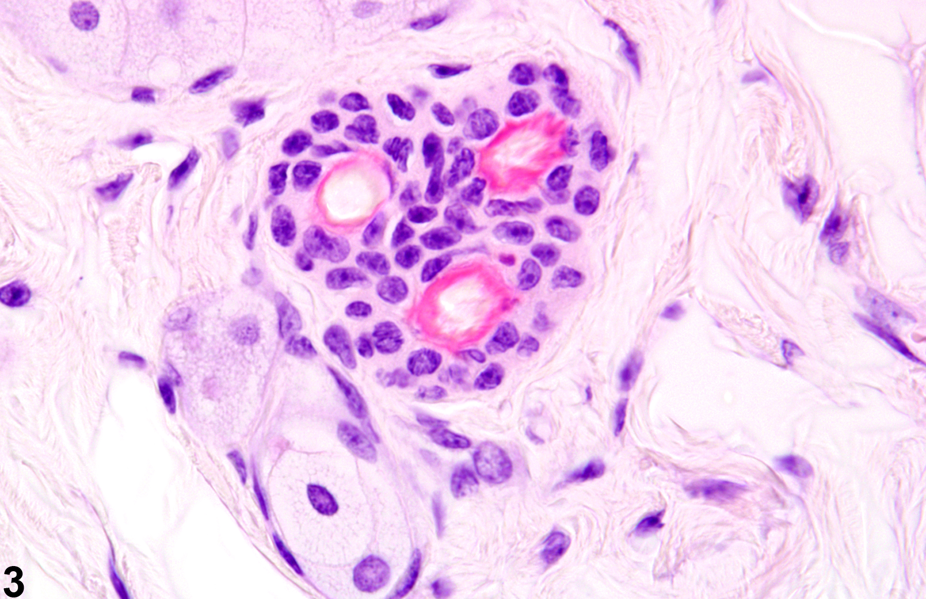 Image of atrophy in the skin adnexa from a male B6C3F1 mouse in a chronic study