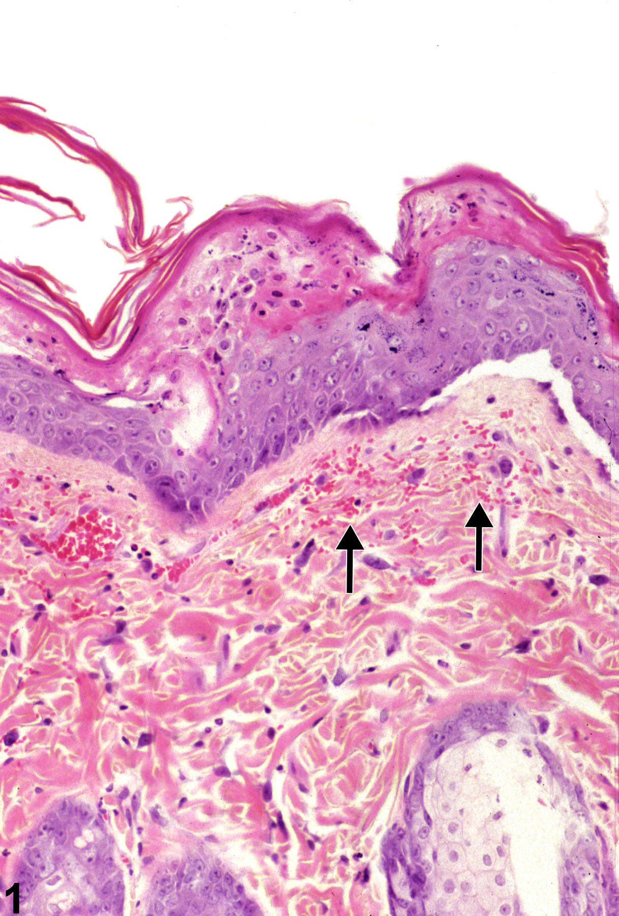 Image of hemorrhage in the skin from a male F344/N rat in a subchronic study