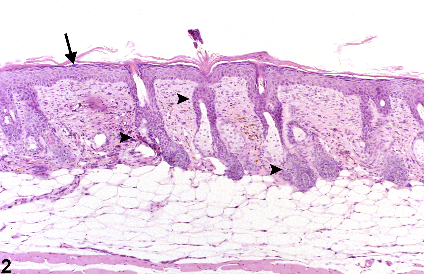 Image of Hyperplasia in the Skin from a Female B6C3F1 Mouse in a 90-day  Study